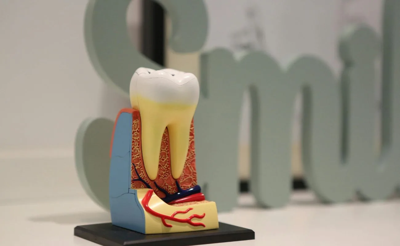 Dental providencia implantes
